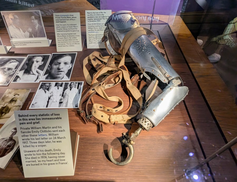 IWM display case with photos and a prosthetic arm